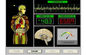 34 κβαντική υπο- συσκευή ανάλυσης υγείας εκθέσεων, αναλυτής σώματος Bioelectric προμηθευτής